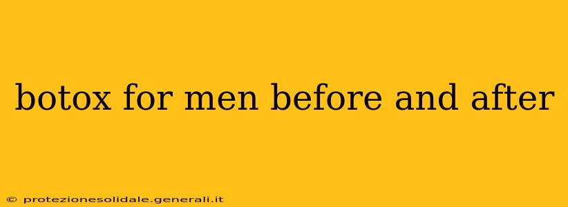botox for men before and after