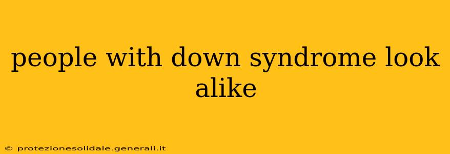 people with down syndrome look alike