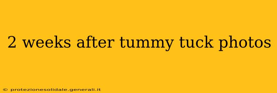 2 weeks after tummy tuck photos