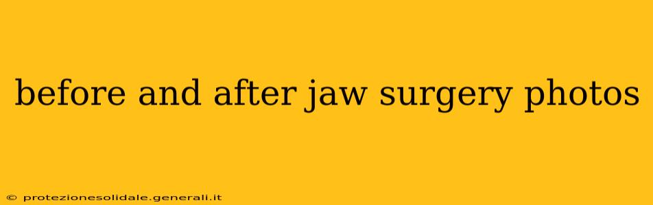 before and after jaw surgery photos
