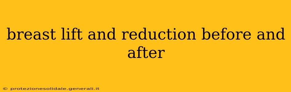 breast lift and reduction before and after