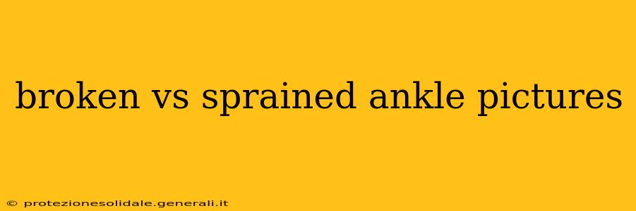 broken vs sprained ankle pictures