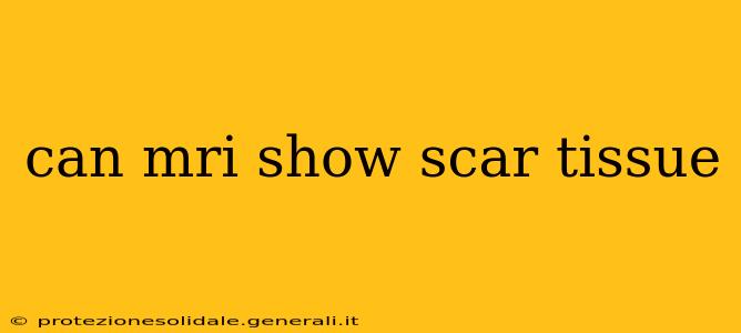 can mri show scar tissue