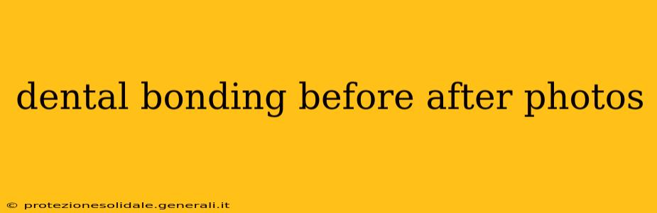dental bonding before after photos