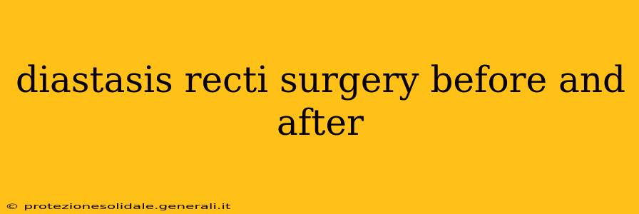diastasis recti surgery before and after