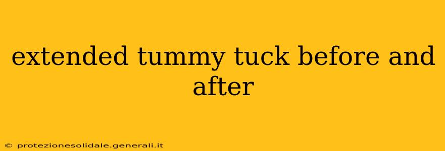 extended tummy tuck before and after