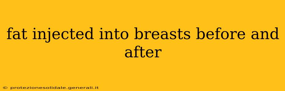 fat injected into breasts before and after