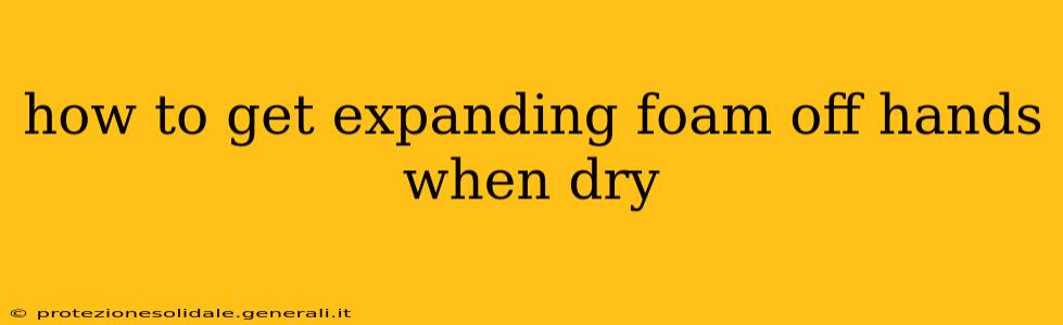 how to get expanding foam off hands when dry