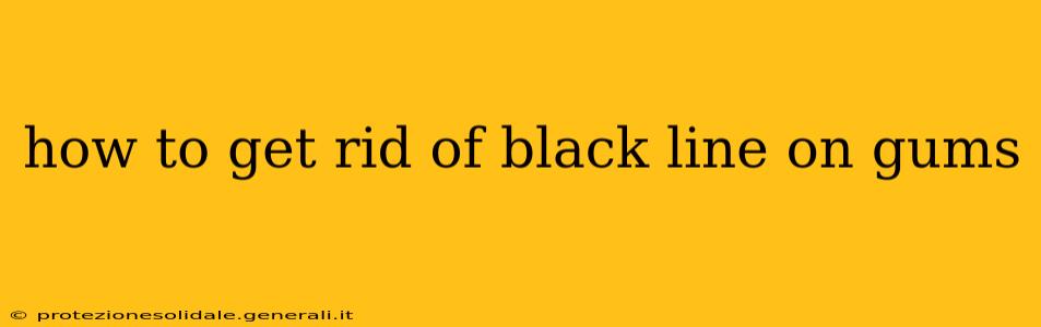 how to get rid of black line on gums