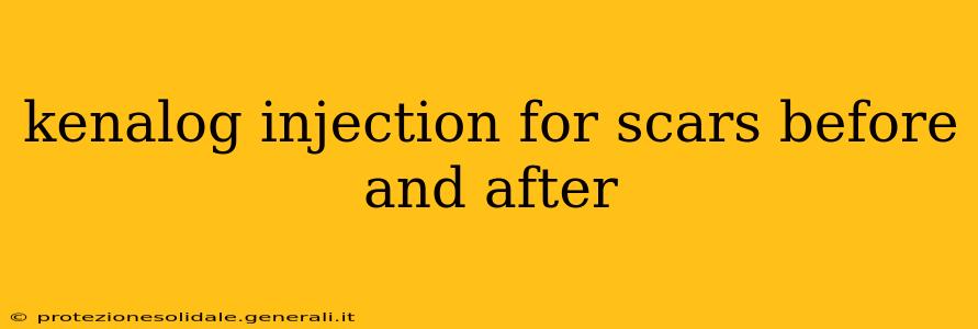 kenalog injection for scars before and after