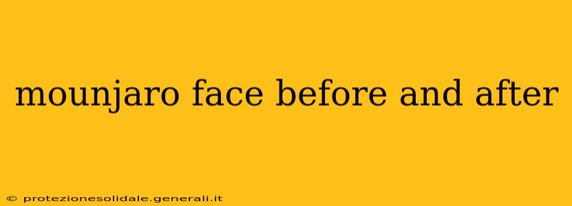 mounjaro face before and after