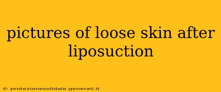 pictures of loose skin after liposuction