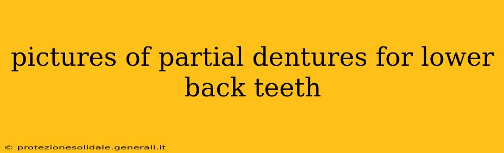 pictures of partial dentures for lower back teeth