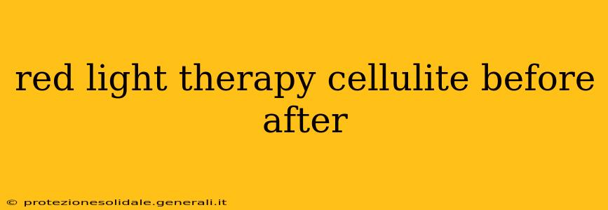 red light therapy cellulite before after