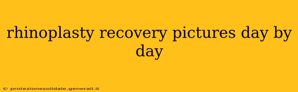 rhinoplasty recovery pictures day by day