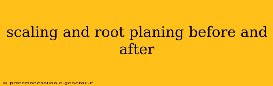 scaling and root planing before and after
