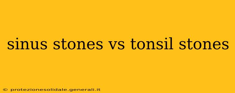 sinus stones vs tonsil stones
