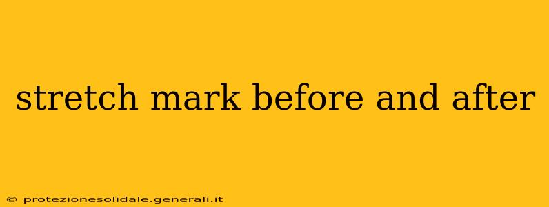 stretch mark before and after