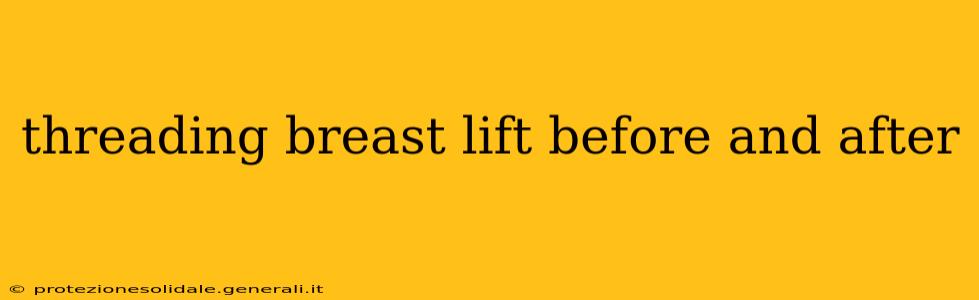 threading breast lift before and after
