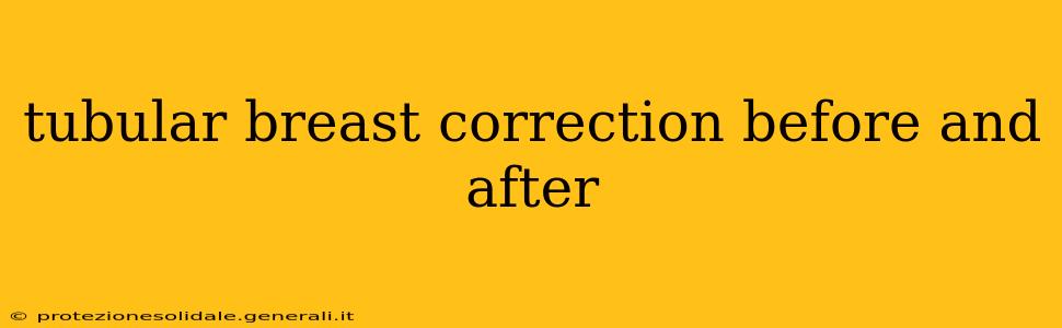 tubular breast correction before and after