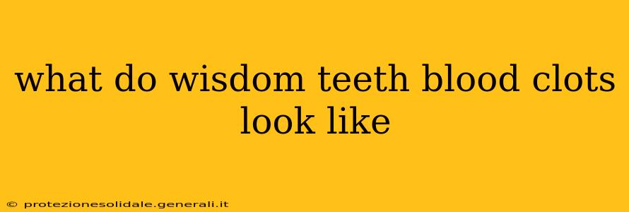 what do wisdom teeth blood clots look like