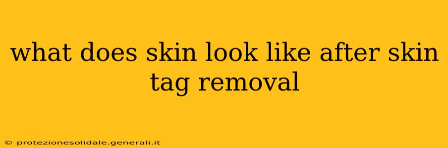 what does skin look like after skin tag removal