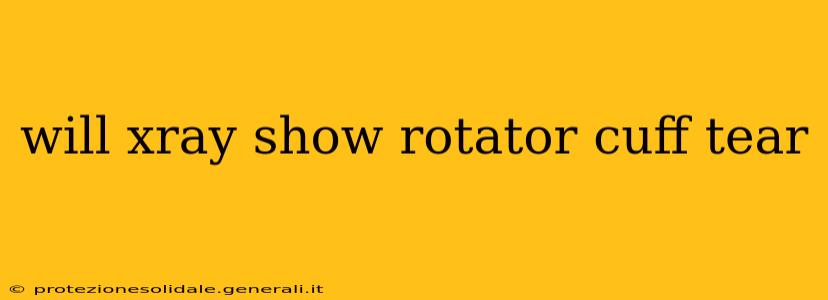 will xray show rotator cuff tear