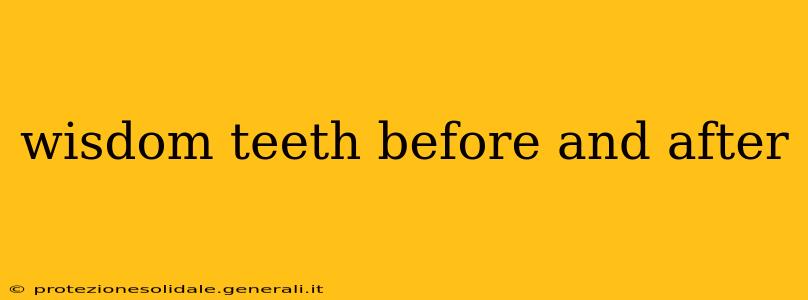 wisdom teeth before and after